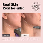 The EMS Face Sculpting Luxe Lift Mask VALUE Set (White Pulse)