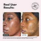 The Needle Lift Even Tone Daily Skincare Kit