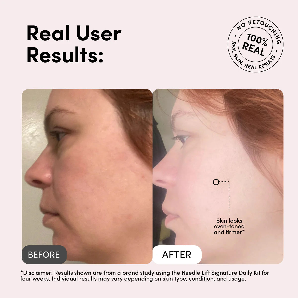 The Needle Lift Signature Daily Skincare Kit