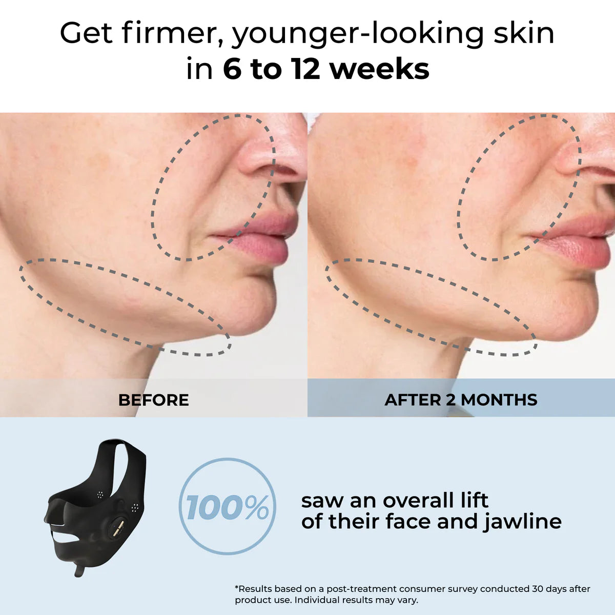 Medi Lift EMS Face Sculpting Mask (patented and wireless)