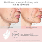 The EMS Face Sculpting Luxe Lift Mask VALUE Set (White Pulse)