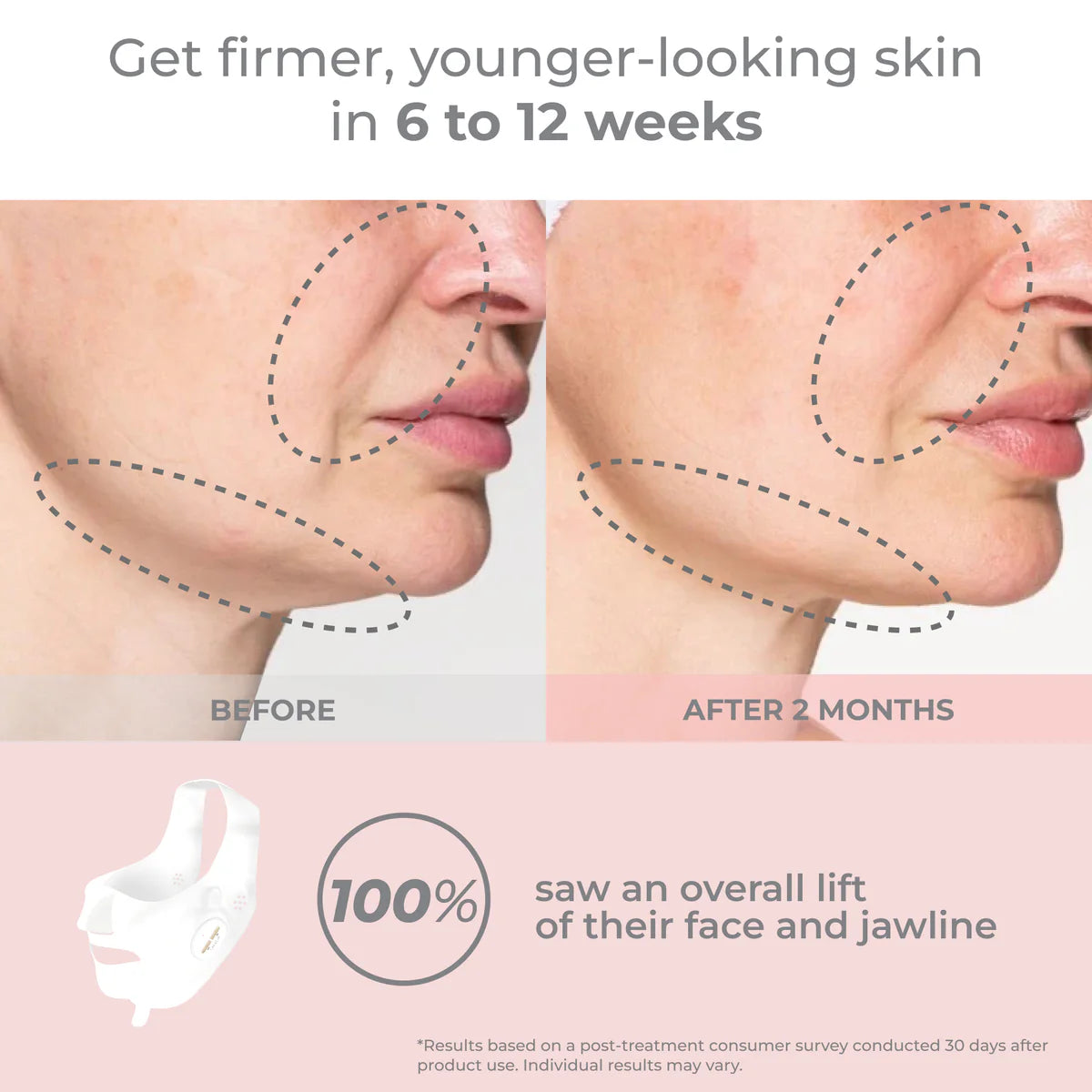 The EMS Face Sculpting Luxe Lift Mask VALUE Set (White Pulse)